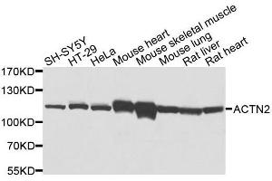 Western blot analysis of extracts of various cell lines, using ACTN2 antibody.