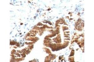 IHC testing of FFPE human gallbladder with TOP1MT antibody (clone TPIMT-1). (TOP1MT anticorps)