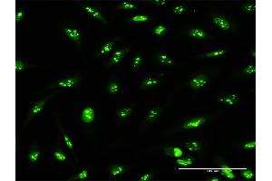 Immunofluorescence of purified MaxPab antibody to PWP2 on HeLa cell. (PWP2 anticorps  (AA 1-919))