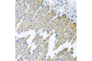Immunohistochemistry of paraffin-embedded mouse stomach using NDUFB10 antibody at dilution of 1:100 (x40 lens). (NDUFB10 anticorps)