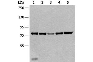 Western blot analysis of Mouse liver tissue Hela cell Human testis tissue Jurkat and HEPG2 cell lysates using ATF6B Polyclonal Antibody at dilution of 1:300 (ATF6B anticorps)