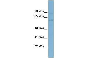 WB Suggested Anti-HSF5 Antibody Titration:  0. (HSF5 anticorps  (Middle Region))