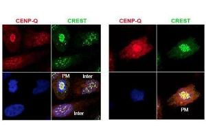 Immunofluorescence microscopy using  protein A purified anti-CENP-Q antibody shows detection of endogenous CENP-Q in HeLa whole cell lysate.