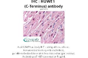 Image no. 1 for anti-HECT, UBA and WWE Domain Containing 1, E3 Ubiquitin Protein Ligase (HUWE1) antibody (ABIN1735641) (HUWE1 anticorps)