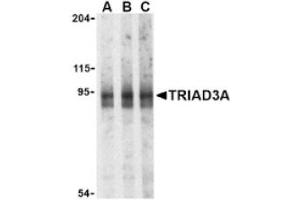 Image no. 1 for anti-Ring Finger Protein 216 (RNF216) (Isoform 1), (N-Term) antibody (ABIN265155)