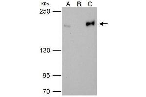 IP Image Topoisomerase II beta antibody immunoprecipitates Topoisomerase II beta protein in IP experiments. (TOP2B anticorps  (C-Term))
