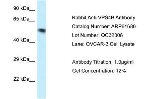 Western Blotting (WB) image for anti-Vacuolar Protein Sorting 4 Homolog B (vps4b) (N-Term) antibody (ABIN2774320) (VPS4B anticorps  (N-Term))