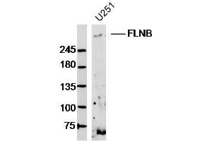 U251 lysates probed with FLNB Polyclonal Antibody, Unconjugated  at 1:300 dilution and 4˚C overnight incubation. (FLNB anticorps  (AA 1551-1650))