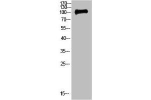 Western Blot analysis of 3T3 cells using Antibody diluted at 500. (CTNND1 anticorps)