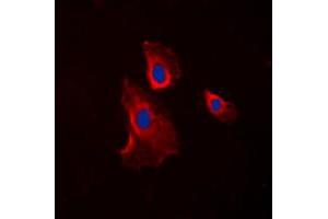Immunofluorescent analysis of Histamine H2 Receptor staining in COLO205 cells. (HRH2 anticorps  (Center))