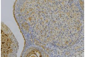 ABIN6276997 at 1/100 staining Human gastric tissue by IHC-P. (HSD17B2 anticorps  (C-Term))