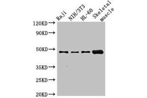 Western Blot Positive WB detected in: Raji whole cell lysate, NIH/3T3 whole cell lysate, HL60 whole cell lysate, Mouse skeletal muscle tissue All lanes: RBM22 antibody at 2. (RBM22 anticorps  (AA 2-250))