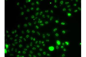 Immunofluorescence analysis of A549 cells using ETV1 antibody. (ETV1 anticorps)