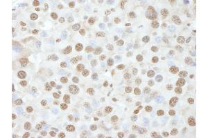 Immunohistochemistry (IHC) image for anti-Nuclear Casein Kinase and Cyclin-Dependent Kinase Substrate 1 (NUCKS1) (AA 1-50) antibody (ABIN7448993) (NUCKS1 anticorps  (AA 1-50))