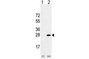 Image no. 1 for anti-Proteasome Subunit alpha 5 (PSMA5) (Middle Region) antibody (ABIN356946) (PSMA5 anticorps  (Middle Region))