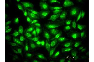 Immunofluorescence of monoclonal antibody to CDKN1B on HeLa cell.