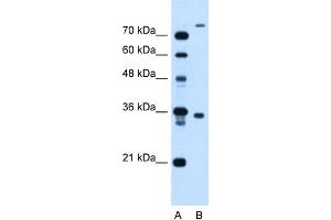 WB Suggested Anti-FLJ22167 Antibody Titration:  1. (FLJ22167 (N-Term) anticorps)