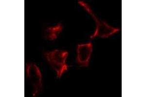 ABIN6266760 staining COLO205 by IF/ICC.