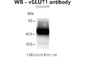 Image no. 1 for anti-Solute Carrier Family 17 (Vesicular Glutamate Transporter), Member 7 (SLC17A7) (C-Term) antibody (ABIN346992)