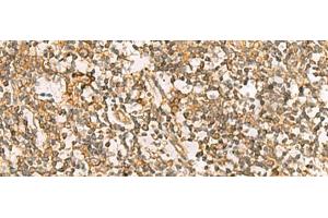 Immunohistochemistry of paraffin-embedded Human tonsil tissue using DNAJA4 Polyclonal Antibody at dilution of 1:55(x200) (DNAJA4 anticorps)