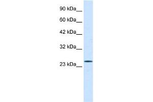 WB Suggested Anti-PCGF3 Antibody Titration:  0. (PCGF3 anticorps  (Middle Region))