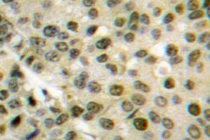 Image no. 1 for anti-V-Akt Murine Thymoma Viral Oncogene Homolog 1 (AKT1) antibody (ABIN271867) (AKT1 anticorps)