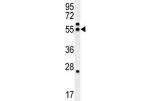 TUBB8B antibody western blot analysis in HeLa lysate.