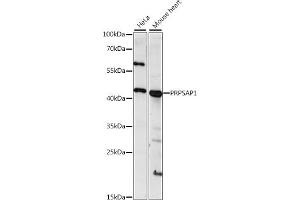 anti-phosphoribosyl Pyrophosphate Synthetase-Associated Protein 1 (PRPSAP1) (AA 30-110) antibody