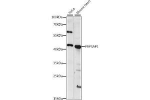 Western blot analysis of extracts of various cell lines, using PRPS antibody (ABIN7269364) at 1:1000 dilution. (PRPSAP1 anticorps  (AA 30-110))