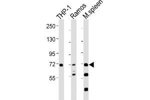 All lanes : Anti-SYK Antibody at 1:2000 dilution Lane 1: THP-1 whole cell lysates Lane 2: Ramos whole cell lysates Lane 3: mouse spleen lysates Lysates/proteins at 20 μg per lane. (SYK anticorps  (AA 268-305))