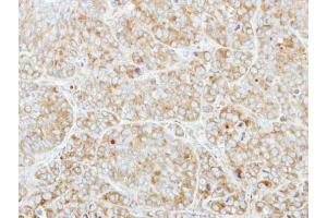IHC-P Image Immunohistochemical analysis of paraffin-embedded MCF7 xenograft, using CSDE1, antibody at 1:250 dilution.