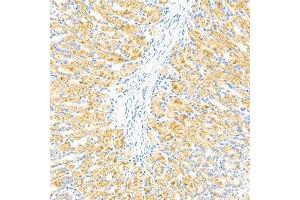 Immunohistochemistry analysis of paraffin-embedded mouse stomach using GBA (ABIN7074062) at dilution of 1: 2000 (GBA anticorps)
