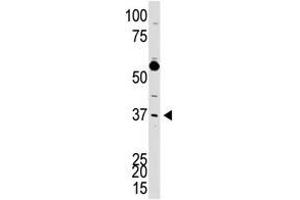 Image no. 1 for anti-DKK3 (N-Term) antibody (ABIN357071) (DKK3 anticorps  (N-Term))