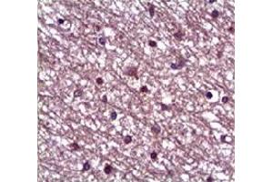 Immunohistochemical staining of formalin-fixed paraffin-embedded human heart showing staining with ANGPT1 polyclonal antibody  at 1:100 dilution. (Angiopoietin 1 anticorps)