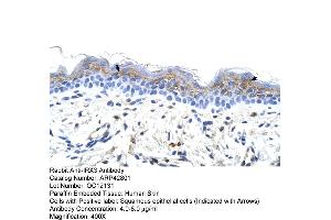 Human Skin (IRX3 anticorps  (C-Term))