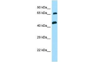 WB Suggested Anti-TXLNA Antibody Titration: 1. (alpha Taxilin anticorps  (C-Term))