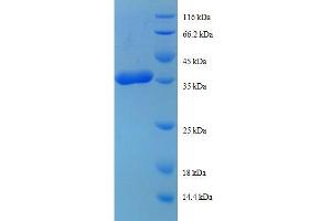Ribosomal Protein L38 (RPL38) (AA 2-70) protein (GST tag) (RPL38 Protein (AA 2-70) (GST tag))