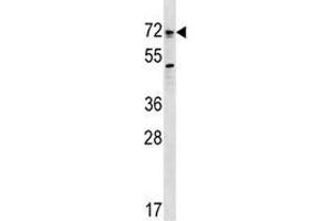 Bmpr1a antibody western blot analysis in SK-BR-3 lysate. (BMPR1A anticorps  (AA 170-197))
