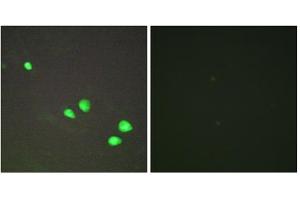 Immunofluorescence analysis of HepG2 cells, using CHD4 antibody.