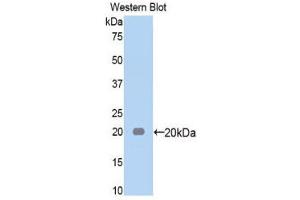 Western Blotting (WB) image for anti-alpha-2-Macroglobulin (A2M) (AA 574-734) antibody (ABIN1857847) (alpha 2 Macroglobulin anticorps  (AA 574-734))