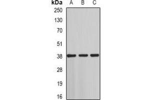 Western blot analysis of ST3GAL4 expression in HT29 (A), rat testis (B), rat liver (C) whole cell lysates. (ST3GAL4 anticorps)