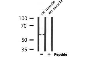 Western blot analysis of extracts from rat muscle, using ENDOD1 Antibody. (ENDOD1 anticorps  (Internal Region))