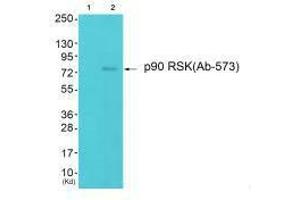 Western blot analysis of extracts from 293 cells (Lane 2), using p90 RSK (Ab-573) antiobdy. (RPS6KA1 anticorps  (Thr573))