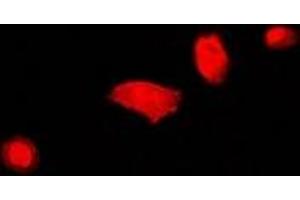 Immunofluorescent analysis of DCAF7 staining in U2OS cells. (DCAF7 anticorps)