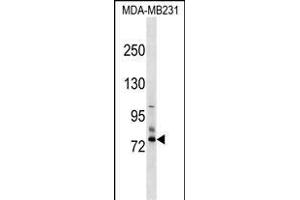 SCNN1D Antibody (N-term) (ABIN1539104 and ABIN2849251) western blot analysis in MDA-M cell line lysates (35 μg/lane). (SCNN1D anticorps  (N-Term))