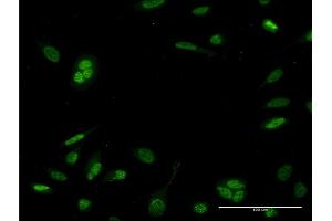 Immunofluorescence of monoclonal antibody to NEUROD6 on HeLa cell. (NEUROD6 anticorps  (AA 191-290))
