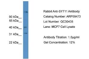 WB Suggested Anti-SYT11  Antibody Titration: 0. (SYT11 anticorps  (N-Term))