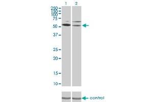 Western blot analysis of STK17A over-expressed 293 cell line, cotransfected with STK17A Validated Chimera RNAi (Lane 2) or non-transfected control (Lane 1).