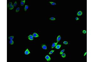 Immunofluorescent analysis of A375 cells using ABIN7146996 at dilution of 1:100 and Alexa Fluor 488-congugated AffiniPure Goat Anti-Rabbit IgG(H+L) (Cathepsin B anticorps  (AA 82-333))