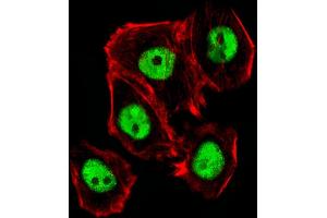Fluorescent image of A431 cells stained with Mouse Ctr9 Antibody (C-term) (ABIN6243851 and ABIN6577807). (CTR9 anticorps  (C-Term))